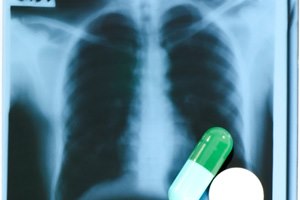 CT: אבחון מוקדם של סרטן הריאות-תמונה