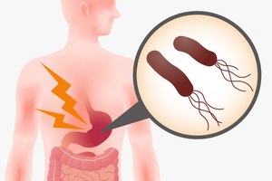 הליקובקטר פילורי: קשה לעיכול-תמונה