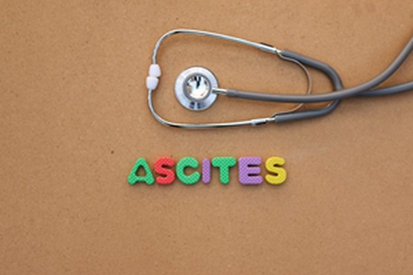 בשורה לסובלים ממיימת!-תמונה