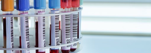 בדיקת Rheumatoid Factor - תמונה