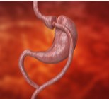 האם ניתוח בריאטרי מאריך את תוחלת החיים?-תמונה