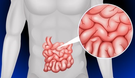 דלקת המעי הדק - תמונת אווירה