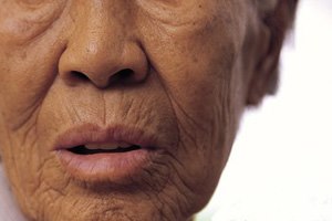 ניתוחים פלסטיים: מתיחת פנים-תמונה