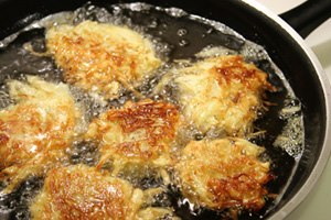 חנוכה: כך תימנעו מכוויות-תמונה