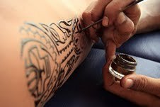 כתוב בעור: איך מסירים קעקוע-תמונה