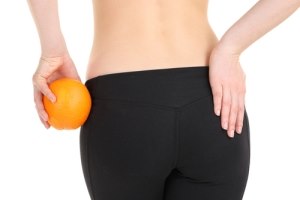 חידוש: שאיבת שומן בלייזר - למי מתאים?-תמונה