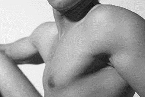 ניתוח הקטנת חזה לגברים-תמונה