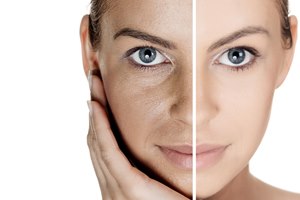 בלי ניתוח: פנים צעירות וחלקות-תמונה