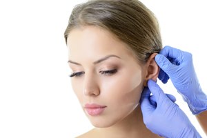 ניתוח להצמדת אוזניים: מדריך-תמונה