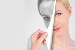 מתיחת פנים: למתוח את הזמן אחורנית-תמונה