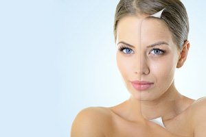 טיפול פנים: שיטת MY CELLS-תמונה