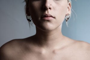 הסרת נגעים עוריים בשיטת מוז-תמונה