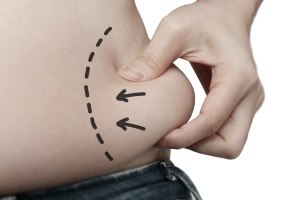 הישראלים בוחרים בשאיבת שומן-תמונה