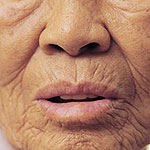 עור לגויים-תמונה