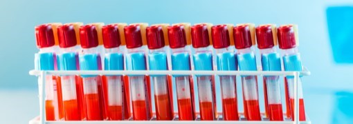 בדיקת דם Blood Type - תמונה