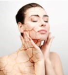 אביב הגיע, היובש בא: 4 טיפים טבעיים לטיפול ביובש בפנים-תמונה