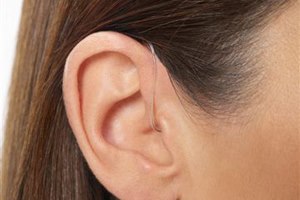 מכשירי שמיעה: הסבסוד לא עזר-תמונה