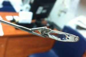 בת 15 בלעה סיכת ביטחון-תמונה