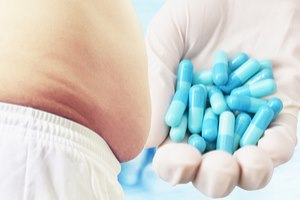 סוכרת: תרופות וניתוח בריאטרי-תמונה