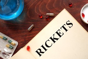 הכל על רככת ואוסטיאומלציה-תמונה