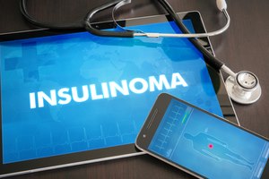 גידול אינסולינומה: סיכוי גבוה לריפוי-תמונה