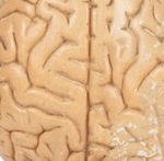 המוח והסוכרת-תמונה