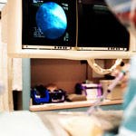 מוסר כליות - על מחלות כליות וחולי סוכרת-תמונה