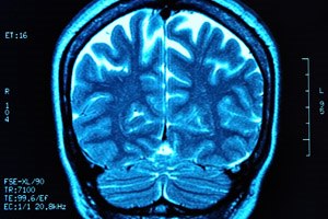 האם צמחים מסוגלים להרגיש? (אילוסטרציה)