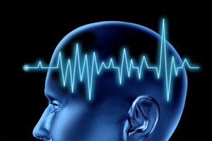 צנתור מוחי: מציל חיים-תמונה