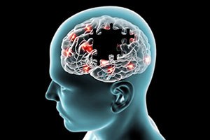 פרקינסון: טיפולים חדשניים-תמונה