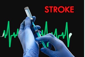 שבץ: שיפור בטיפול אך לא במודעות-תמונה