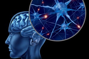 טרשת נפוצה: אבחון וטיפול-תמונה