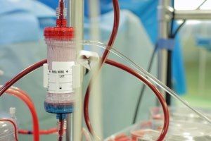 מחלת כליות כרונית: לטפל מוקדם-תמונה