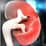 חדש בשיבא: סריקה נפרו-גנטית-תמונה