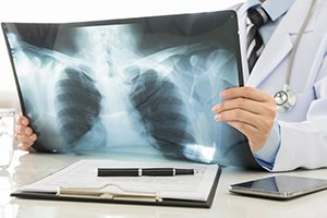 דימות: חשיבות הדעה הנוספת