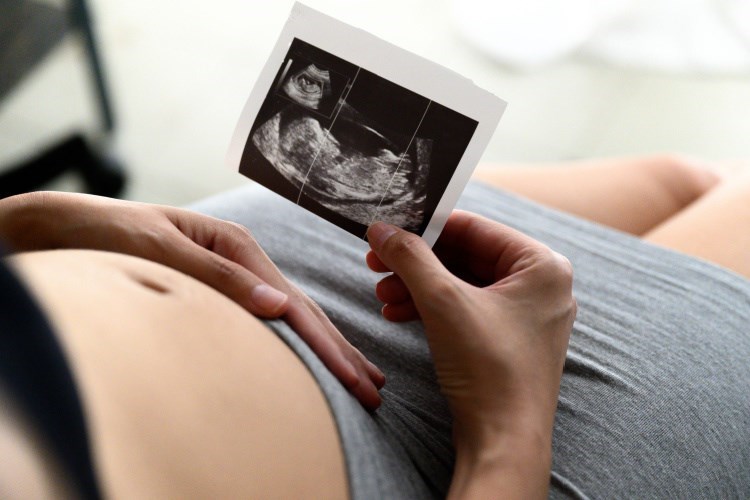 בדיקת אולטרסאונד בהריון