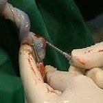 שימור דם טבורי - מורה נבוכים-תמונה