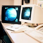 מדריך לאולטראסאונד בהריון-תמונה