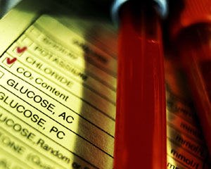 זוהה גן לניוון מוחי בקרב קווקזים-תמונה