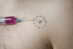 מכוני שיזוף: לא לבני נוער-תמונה