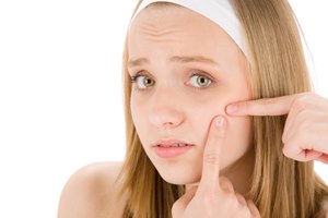 וידיאו: מנורת הקסמים נגד אקנה-תמונה