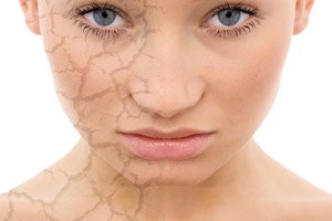 מחלות עור: לראות את האור-תמונה