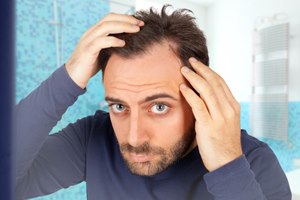 התקרחות: סערה על כל שערה-תמונה