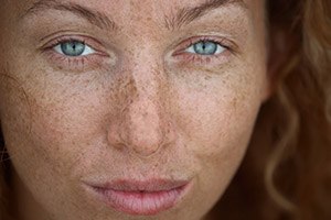 כתם על העור: מה עושים?-תמונה