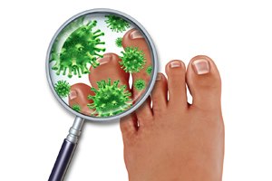 פטרת ציפורניים: כך תיפטרו ממנה-תמונה