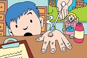 יבלות ויראליות: מגוון טיפולים-תמונה