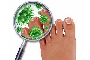 פטרת ציפורניים? כך תיפטרו ממנה!-תמונה