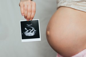 סקירת מערכות: כל מה שחשוב לדעת-תמונה