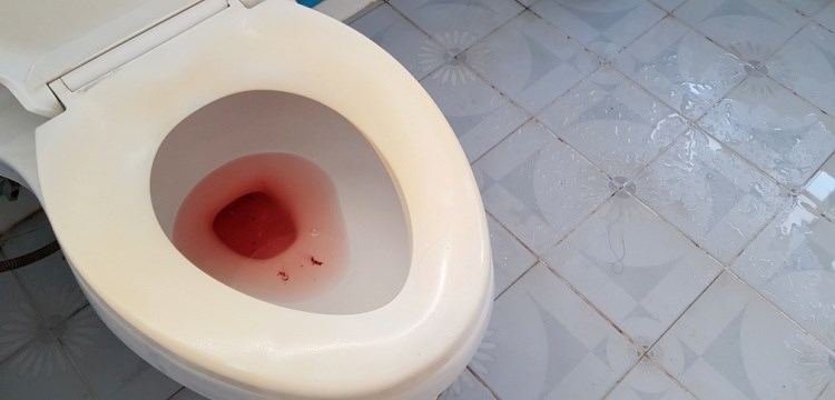 דם בשתן