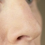 צרכנות רפואית מס' 100-תמונה